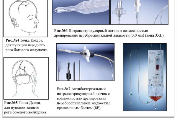 Как зарегистрироваться на кракене из россии